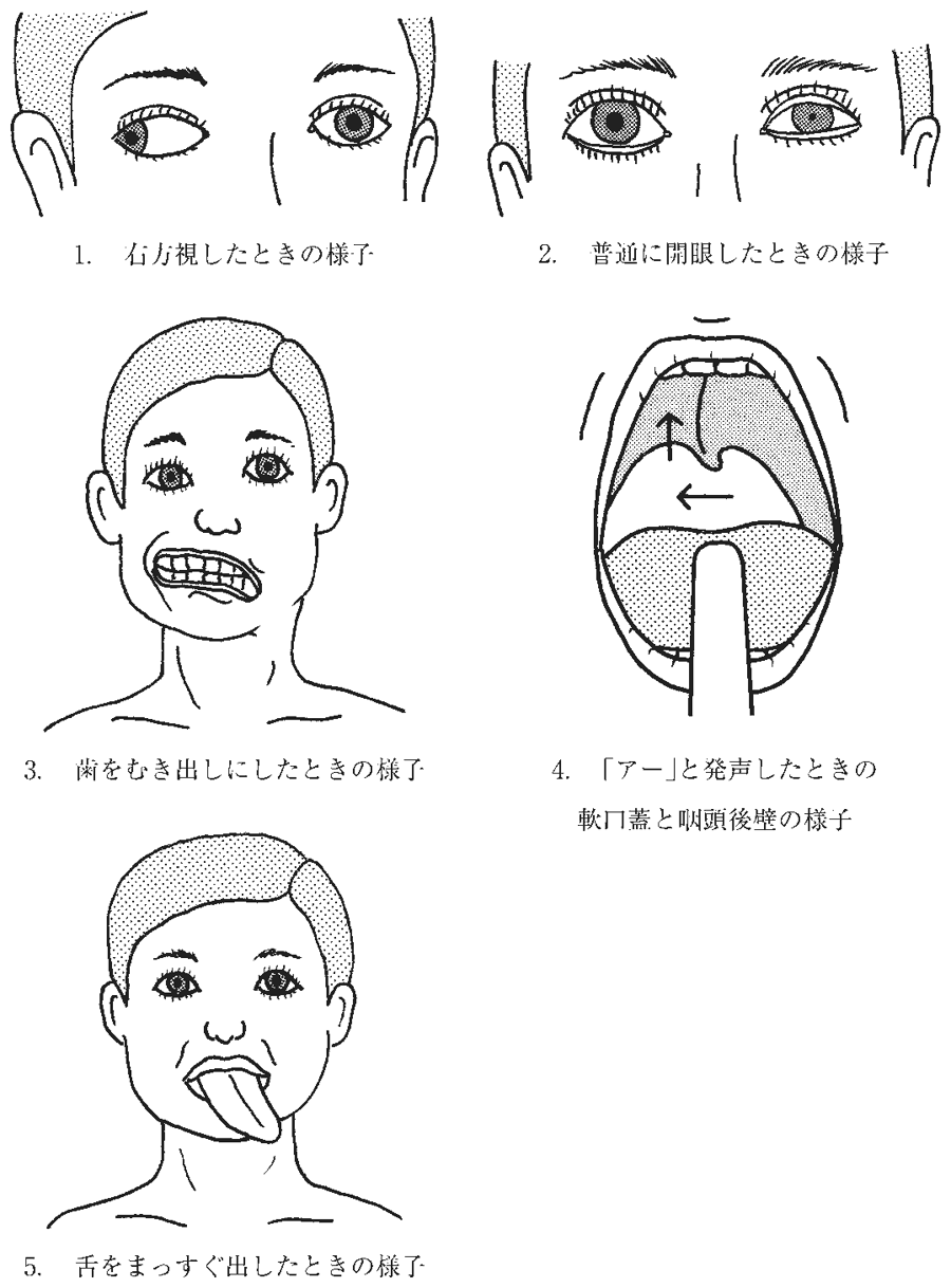 第58回午前 PT 問7 図(出典:厚生労働省)